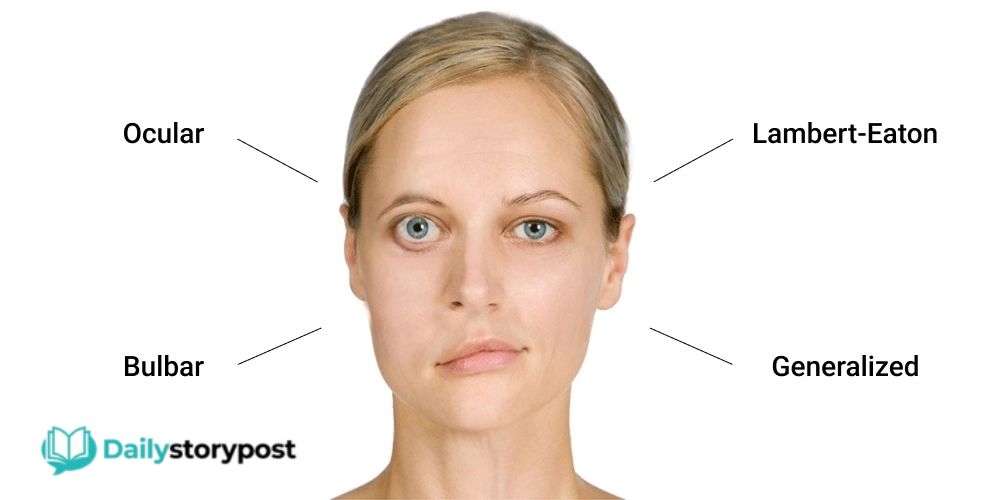 myasthenia gravis